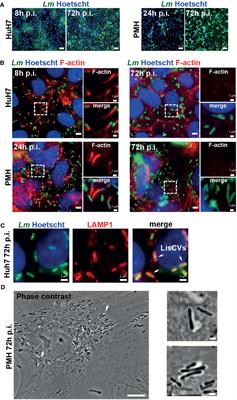 An Immunomodulatory Transcriptional Signature Associated With Persistent Listeria Infection in Hepatocytes